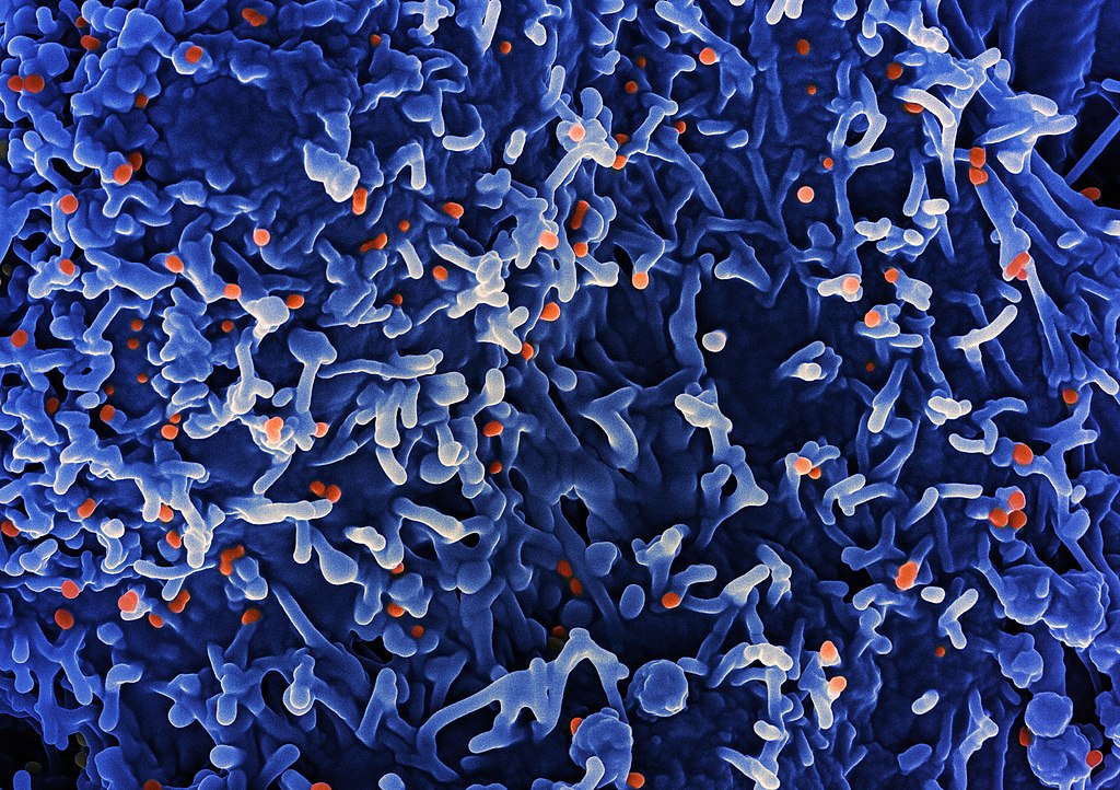Micrographie électronique à balayage colorisée du virus mpox (orange) à la surface des cellules VERO E6 infectées (bleu). Image capturée au Centre de recherche intégré (IRF) du NIAID à Fort Detrick, Maryland. Crédit: NIAID
